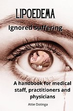 Lipoedema
