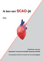 IkbeneenSCAD-je