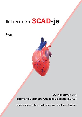 IkbeneenSCAD-je