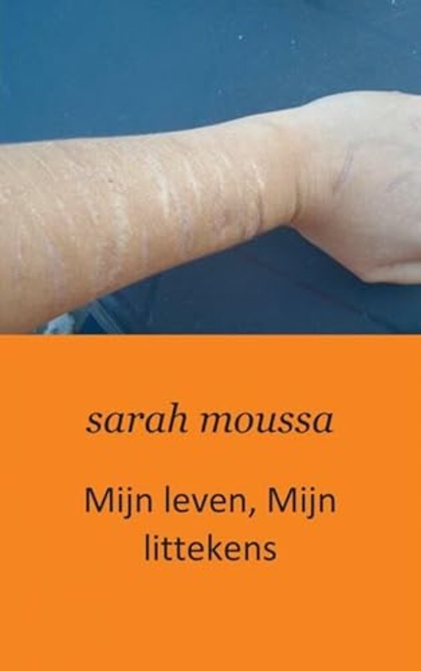Mijn leven, mijn littekens