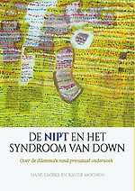 De NIPT en het syndroom van Down