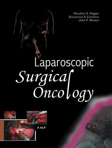 Laparoscopic Surgical Oncology