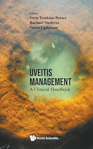 Uveitis Management: A Clinical Handbook