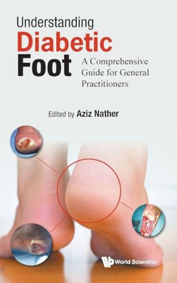 Understanding Diabetic Foot: A Comprehensive Guide For General Practitioners