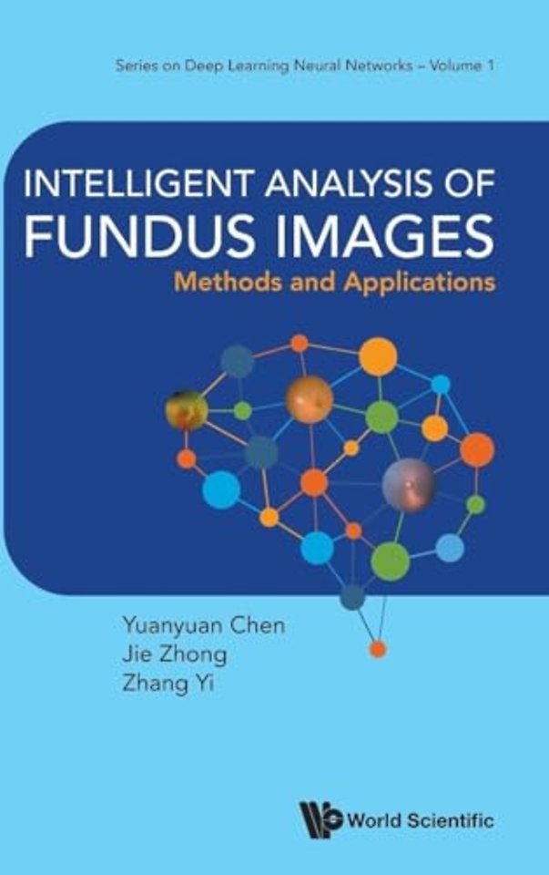 Intelligent Analysis Of Fundus Images: Methods And Applications