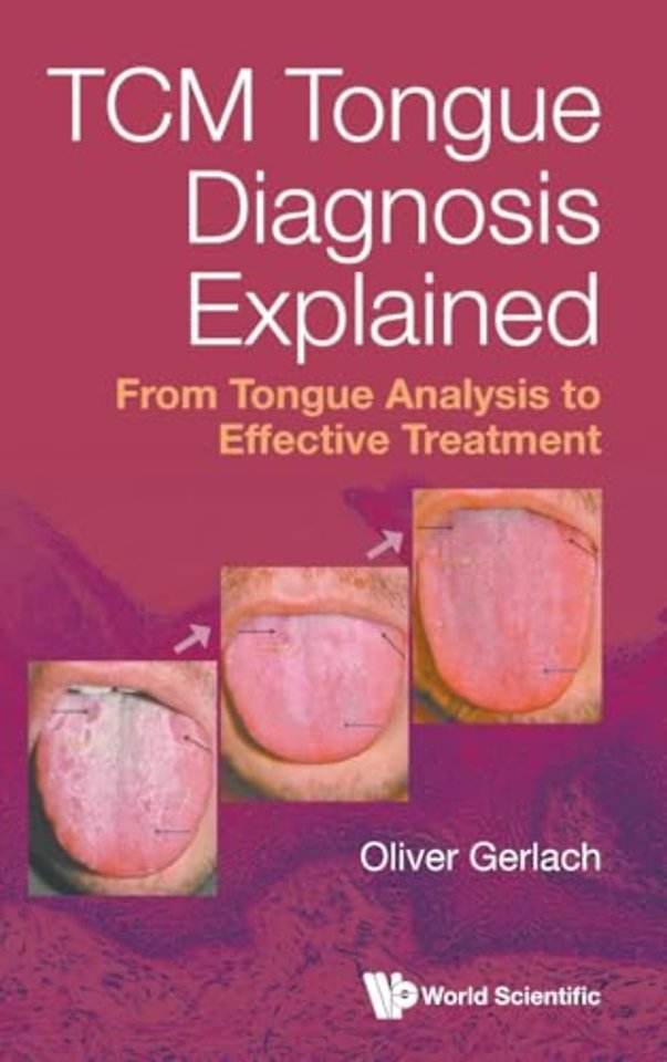 Tcm Tongue Diagnosis Explained: From Tongue Analysis To Effective Treatment