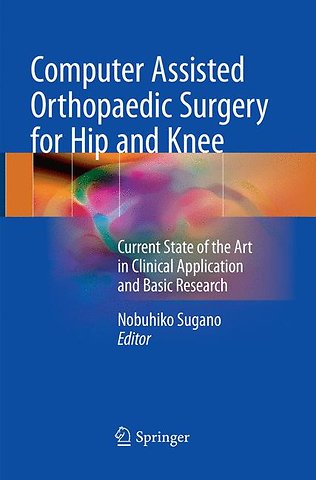 Computer Assisted Orthopaedic Surgery for Hip and Knee