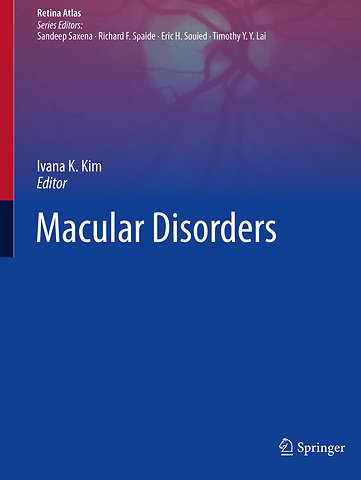 Macular Disorders