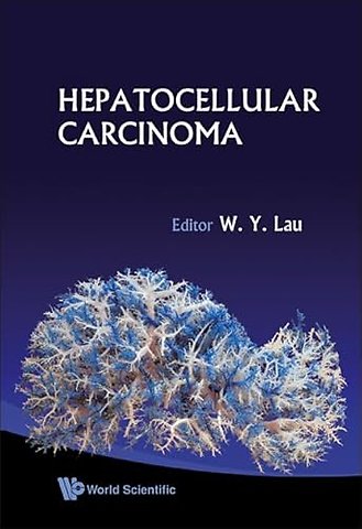 Hepatocellular Carcinoma