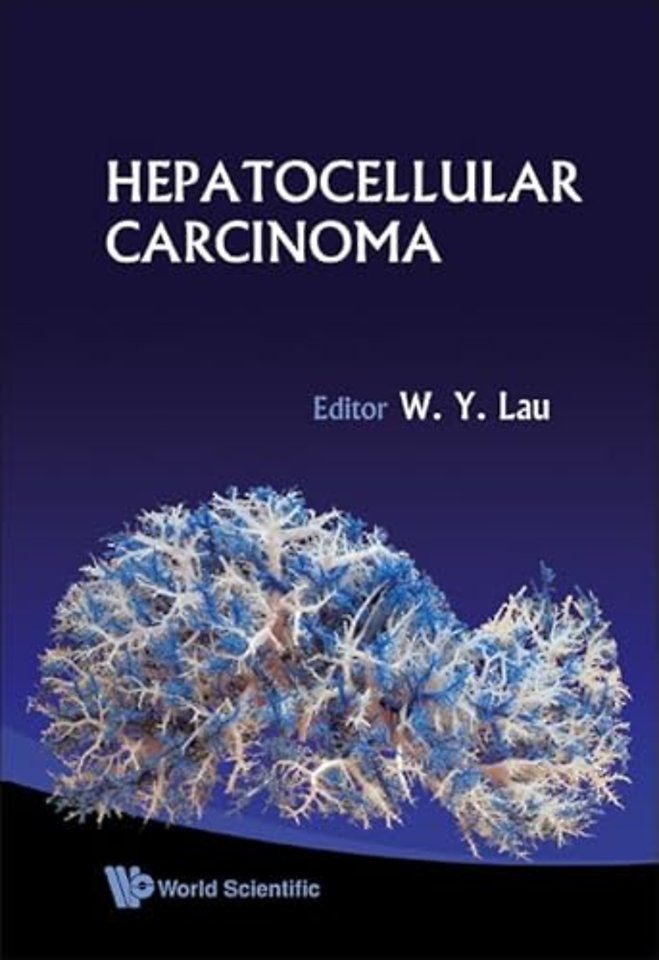 Hepatocellular Carcinoma