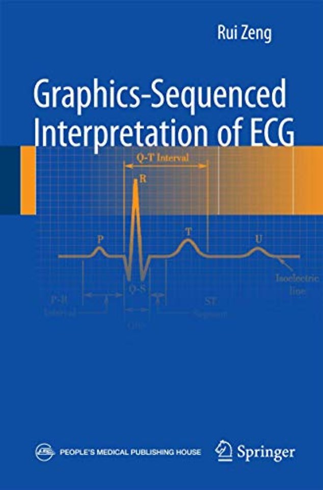 Graphics-sequenced interpretation of ECG