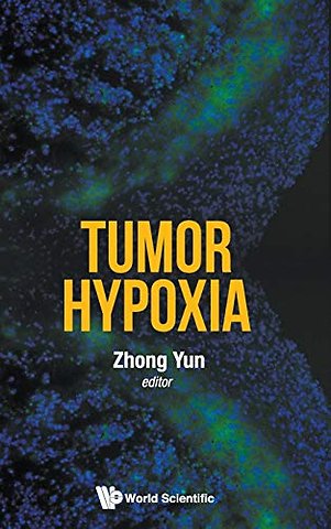 Tumor Hypoxia
