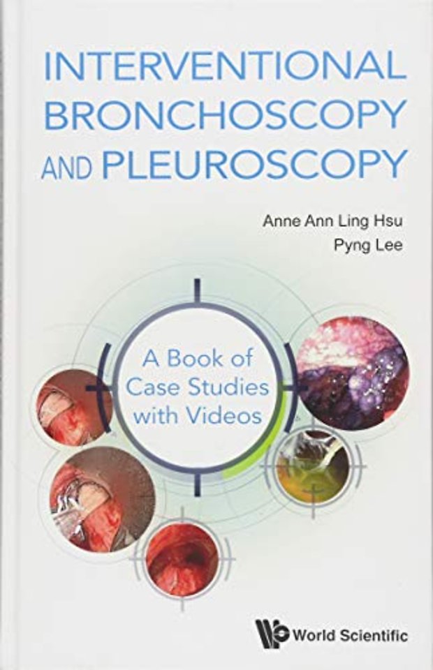 Interventional Bronchoscopy And Pleuroscopy: A Book Of Case Studies With Videos