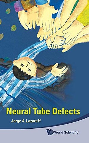 Neural Tube Defects