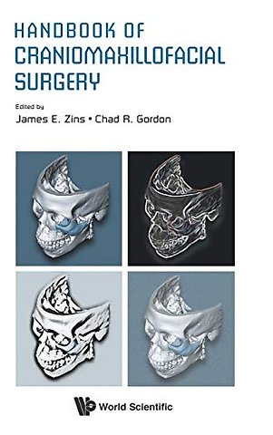 Handbook Of Craniomaxillofacial Surgery