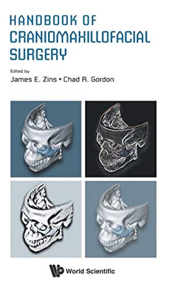 Handbook Of Craniomaxillofacial Surgery
