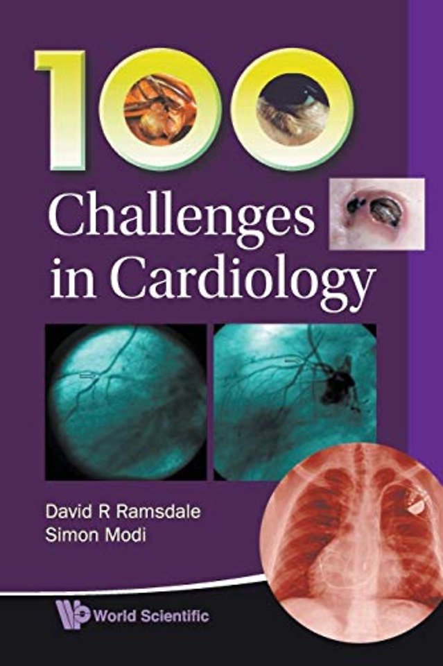 100 Challenges In Cardiology