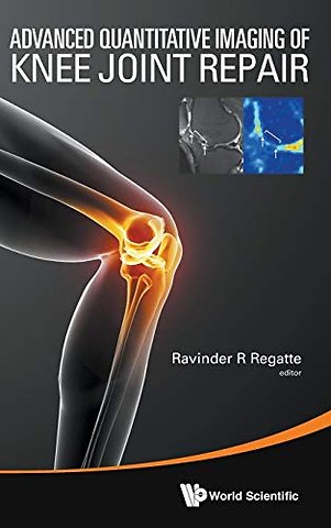 Advanced Quantitative Imaging Of Knee Joint Repair