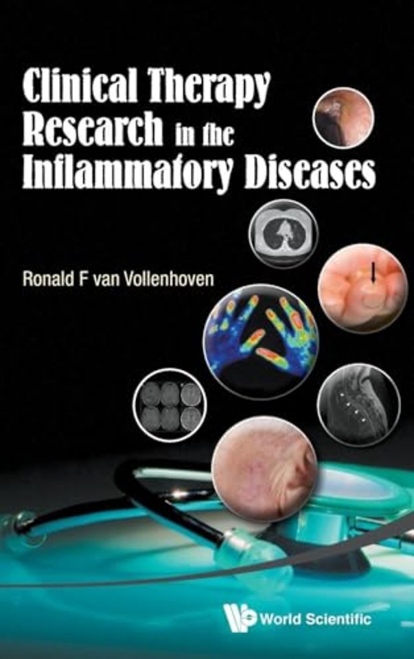Clinical Therapy Research In The Inflammatory Diseases
