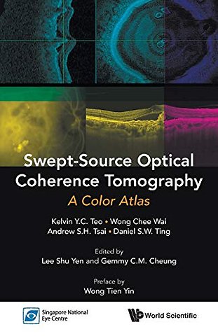 Swept-source Optical Coherence Tomography: A Color Atlas
