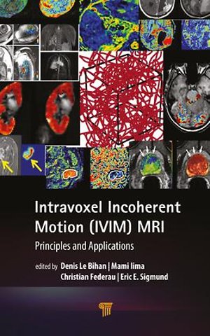 Intravoxel Incoherent Motion (IVIM) MRI