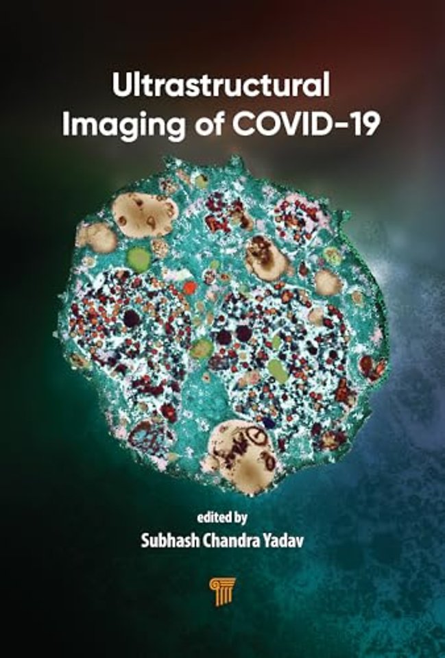 Ultrastructural Imaging of COVID-19