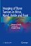 Imaging of Bone Tumors in Wrist, Hand, Ankle and Foot