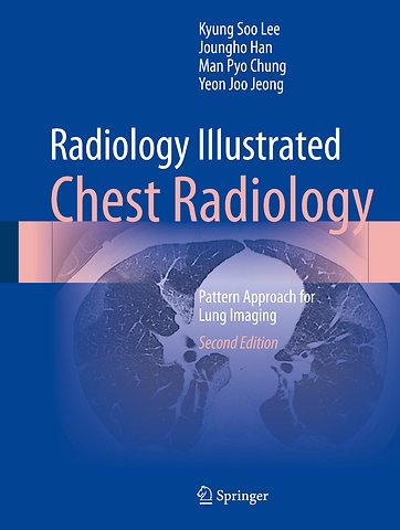 Radiology Illustrated: Chest Radiology