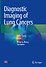 Diagnostic Imaging of Lung Cancers