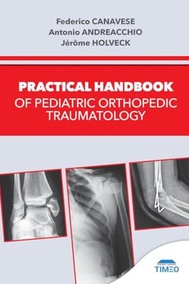 Practical Handbook of Pediatric Orthopedic Traumatology