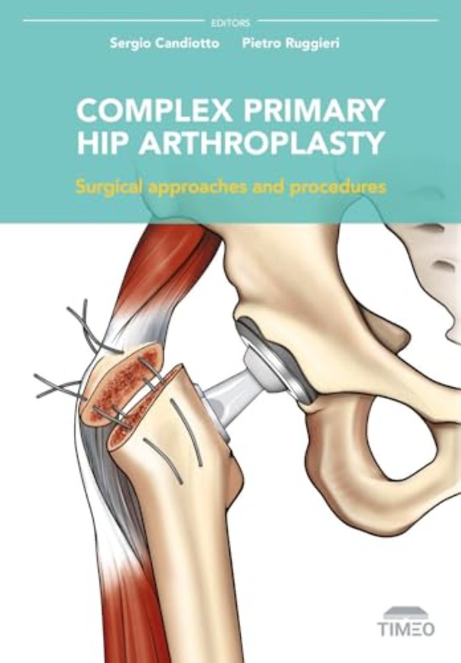 Complex Primary Hip Arthroplasty – Surgical Approaches and Procedures