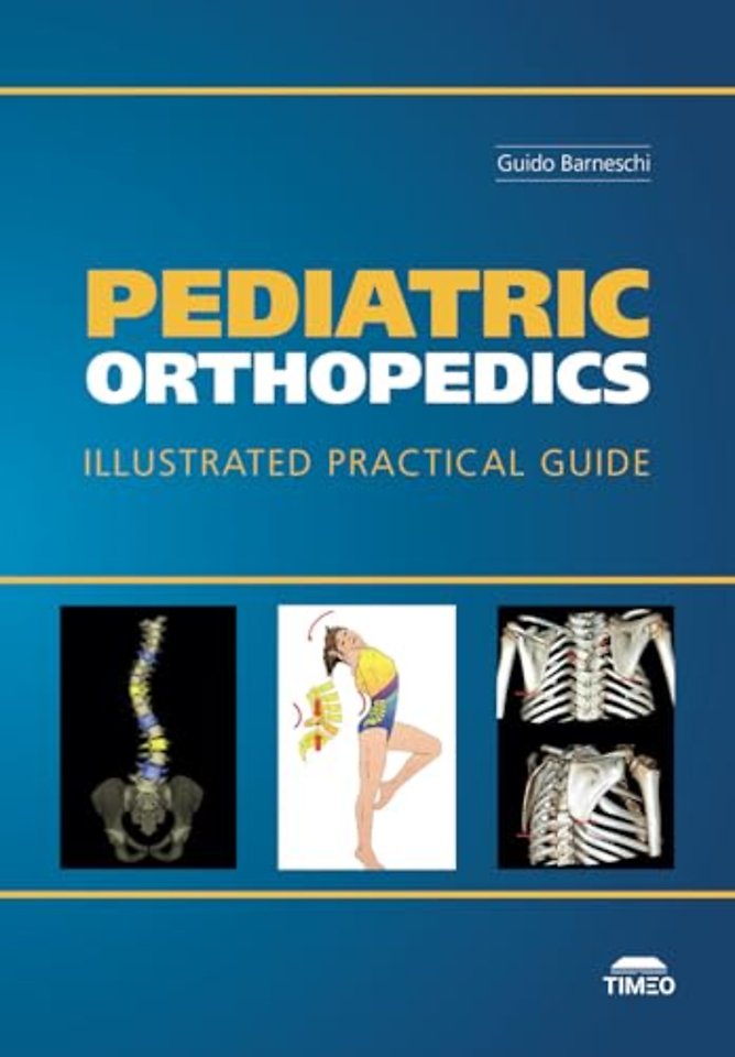 Pediatric Orthopedics – Illustrated Practical Guide