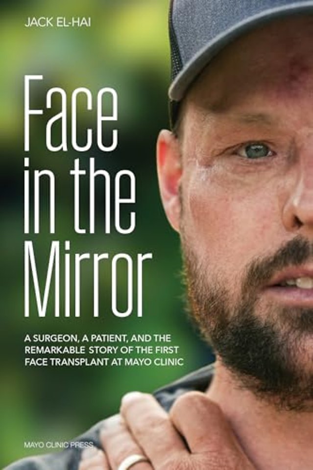 Face Transplant