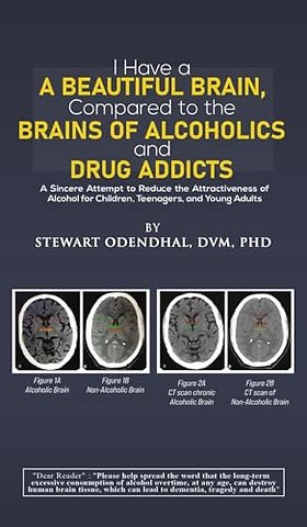 I Have a Beautiful Brain, Compared to the Brains of Alcoholics and Drug Addicts
