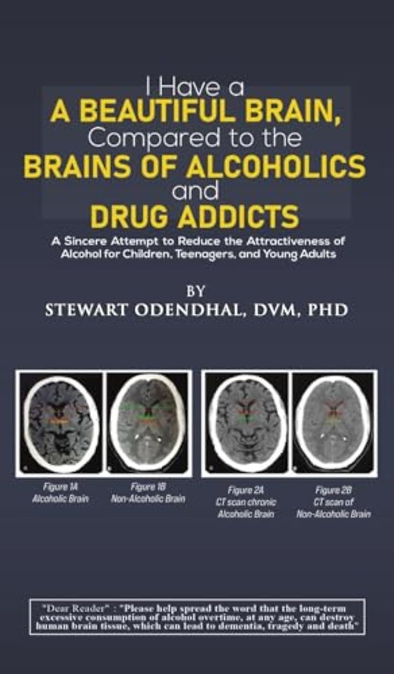 I Have a Beautiful Brain, Compared to the Brains of Alcoholics and Drug Addicts