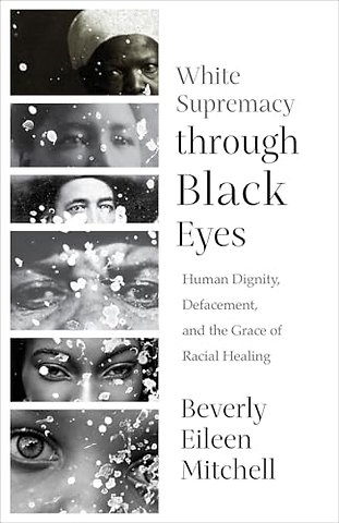 White Supremacy through Black Eyes